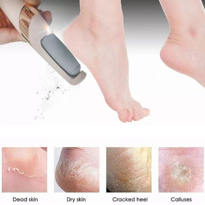 Appareil Pédicure Electrique Peau Morte Talons Fendus