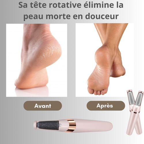 Appareil Pédicure Electrique Peau Morte Talons Fendus